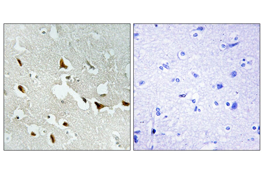 Immunohistochemistry - Anti-IRS-1 Antibody (B7122) - Antibodies.com