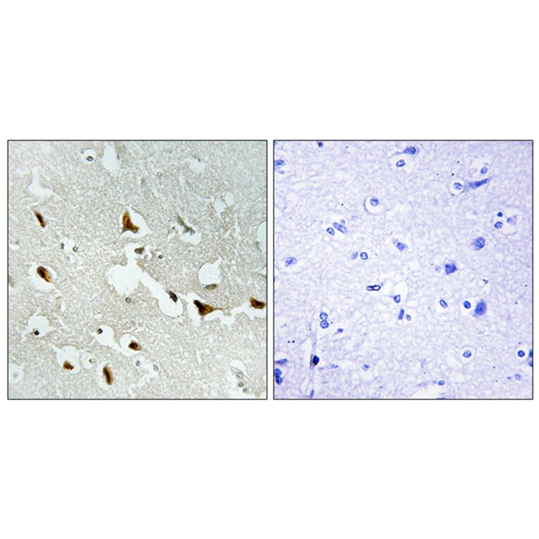 Immunohistochemistry - Anti-IRS-1 Antibody (B7122) - Antibodies.com