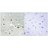 Immunohistochemistry - Anti-IRS-1 Antibody (B7122) - Antibodies.com