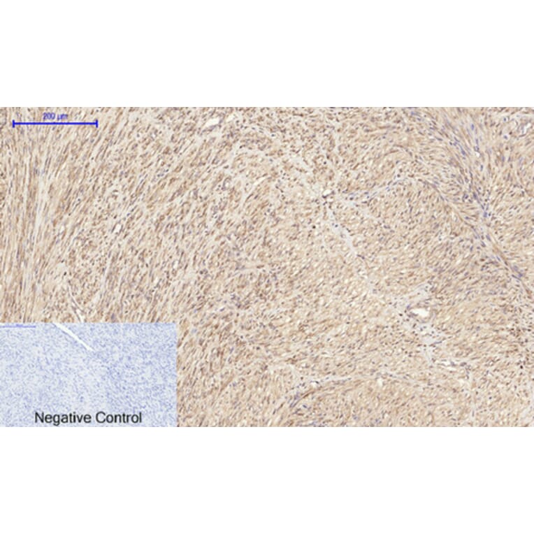 Immunohistochemistry - Anti-IRS-1 Antibody (B7122) - Antibodies.com