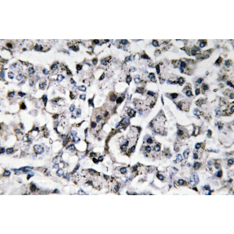 Immunohistochemistry - Anti-IL-11 Antibody (R12-2199) - Antibodies.com