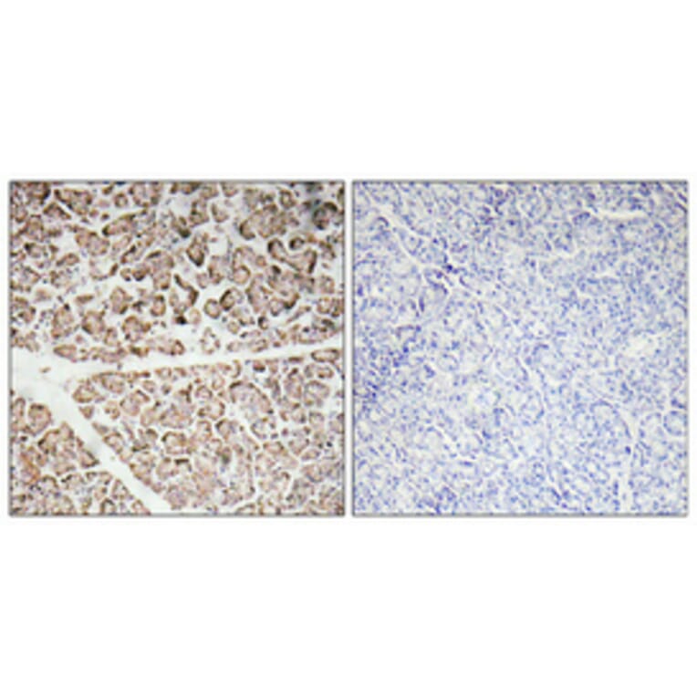Immunohistochemistry - Anti-IGF-I Antibody (R12-2195) - Antibodies.com