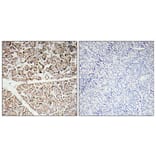 Immunohistochemistry - Anti-IGF-I Antibody (R12-2195) - Antibodies.com