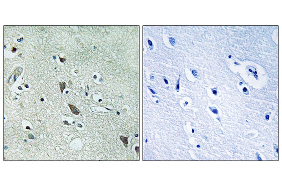 Immunohistochemistry - Anti-HtrA2 Antibody (B8354) - Antibodies.com