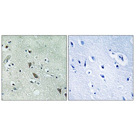Immunohistochemistry - Anti-HtrA2 Antibody (B8354) - Antibodies.com