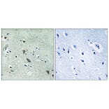 Immunohistochemistry - Anti-HtrA2 Antibody (B8354) - Antibodies.com