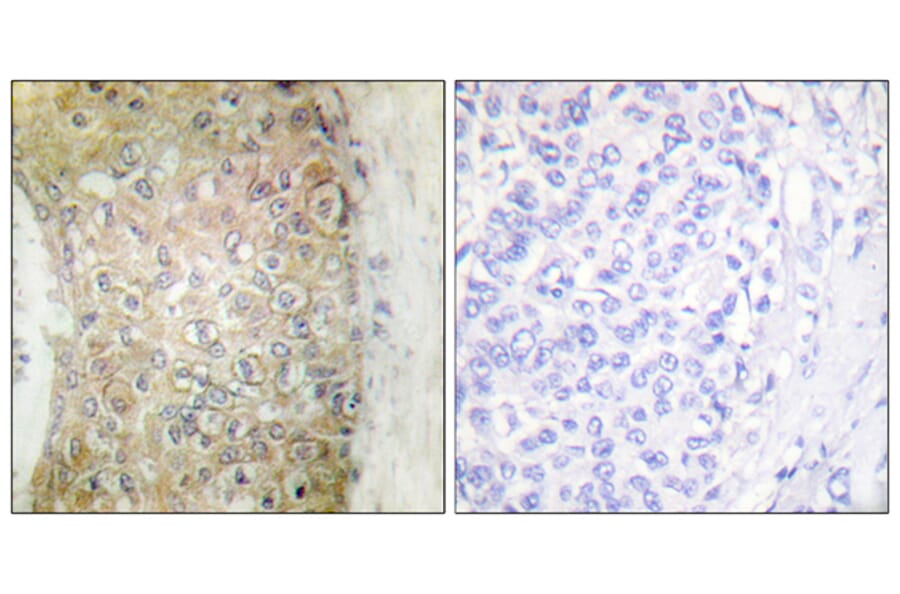 Immunohistochemistry - Anti-HSP20 Antibody (B0488) - Antibodies.com
