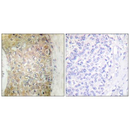 Immunohistochemistry - Anti-HSP20 Antibody (B0488) - Antibodies.com