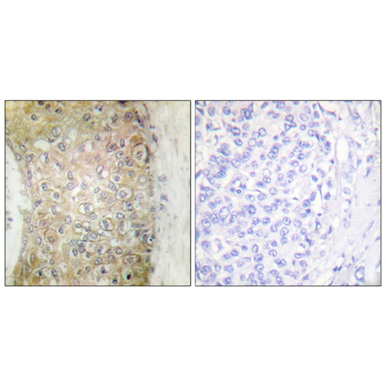 Immunohistochemistry - Anti-HSP20 Antibody (B0488) - Antibodies.com