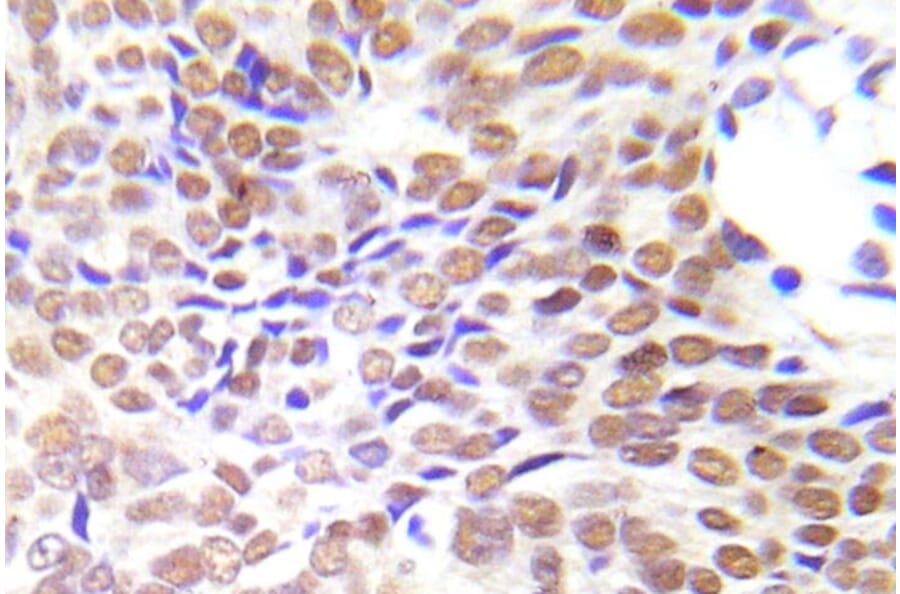Immunohistochemistry - Anti-HDAC1 Antibody (R12-2177) - Antibodies.com