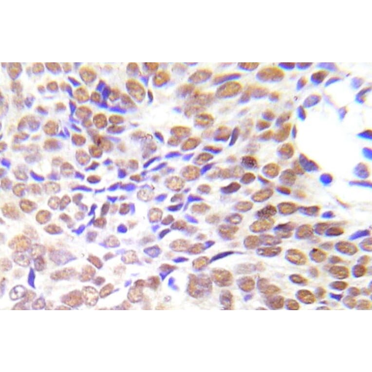 Immunohistochemistry - Anti-HDAC1 Antibody (R12-2177) - Antibodies.com