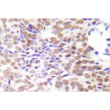 Immunohistochemistry - Anti-HDAC1 Antibody (R12-2177) - Antibodies.com