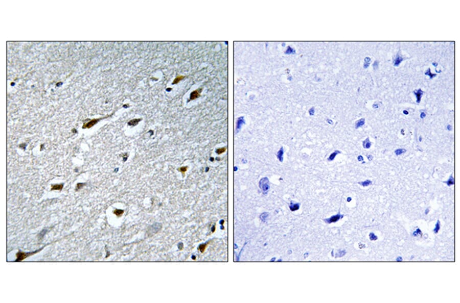 Immunohistochemistry - Anti-HAND1 Antibody (B1034) - Antibodies.com