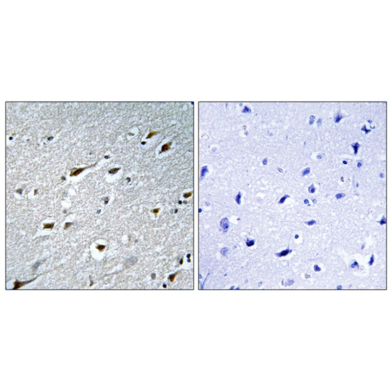 Immunohistochemistry - Anti-HAND1 Antibody (B1034) - Antibodies.com
