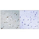 Immunohistochemistry - Anti-HAND1 Antibody (B1034) - Antibodies.com