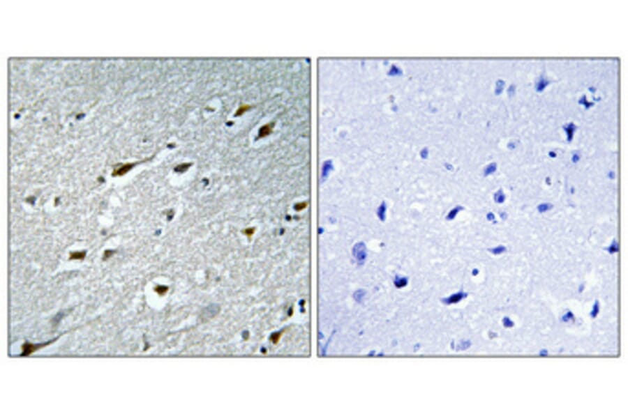 Immunohistochemistry - Anti-HAND1 Antibody (B1034) - Antibodies.com