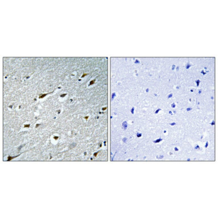 Immunohistochemistry - Anti-HAND1 Antibody (B1034) - Antibodies.com