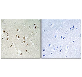 Immunohistochemistry - Anti-GRF-1 Antibody (B0433) - Antibodies.com