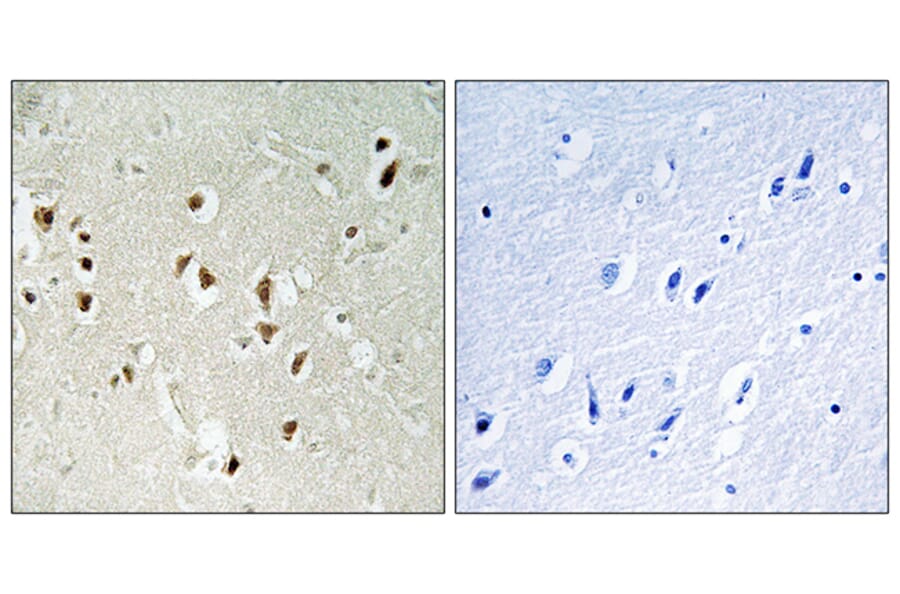 Immunohistochemistry - Anti-GRF-1 Antibody (B0433) - Antibodies.com