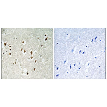 Immunohistochemistry - Anti-GRF-1 Antibody (B0433) - Antibodies.com