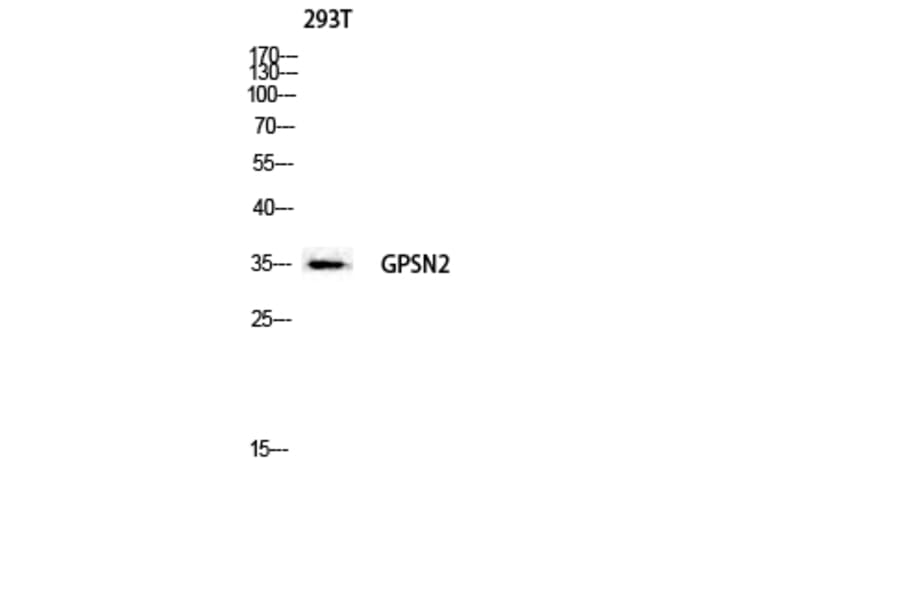 Western Blot - Anti-GPSN2 Antibody (C18998) - Antibodies.com