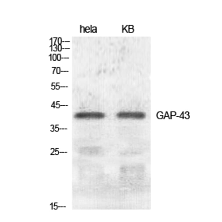 Western Blot - Anti-GAP43 Antibody (B7091) - Antibodies.com