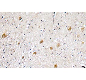 Immunohistochemistry - Anti-FGF-1 Antibody (R12-2141) - Antibodies.com