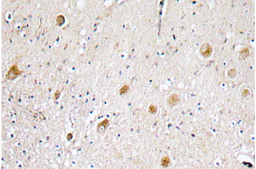Immunohistochemistry - Anti-FGF-1 Antibody (R12-2141) - Antibodies.com