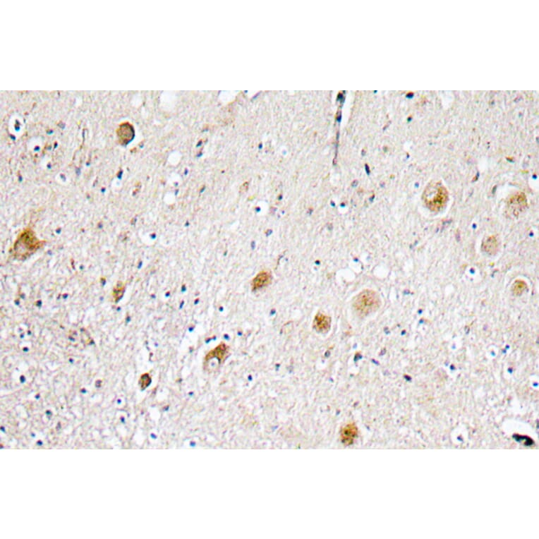 Immunohistochemistry - Anti-FGF-1 Antibody (R12-2141) - Antibodies.com