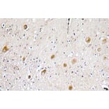 Immunohistochemistry - Anti-FGF-1 Antibody (R12-2141) - Antibodies.com
