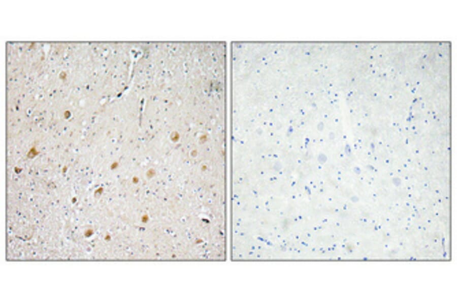 Immunohistochemistry - Anti-FGF-1 Antibody (R12-2141) - Antibodies.com