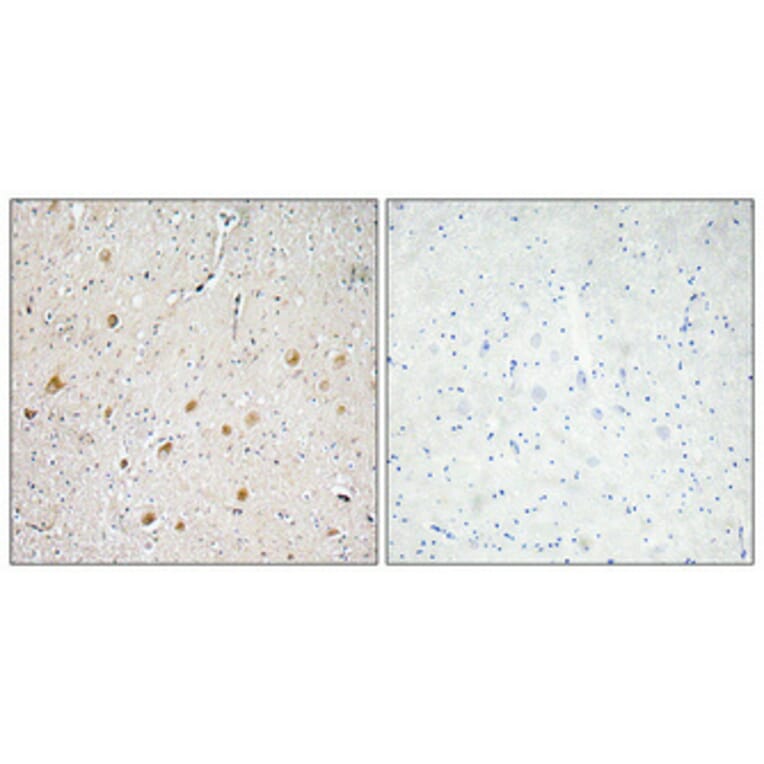 Immunohistochemistry - Anti-FGF-1 Antibody (R12-2141) - Antibodies.com