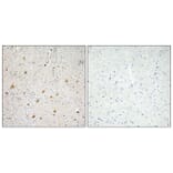 Immunohistochemistry - Anti-FGF-1 Antibody (R12-2141) - Antibodies.com