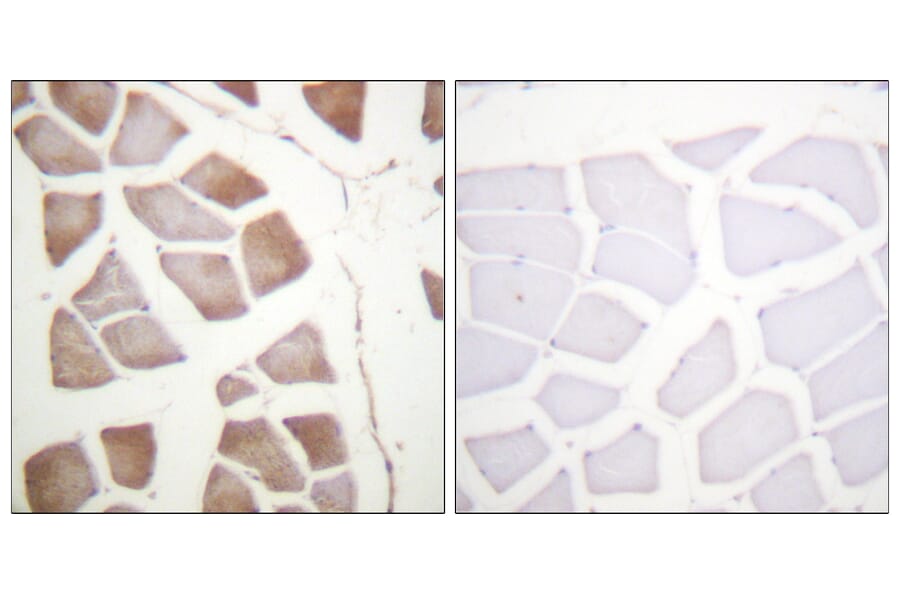 Immunohistochemistry - Anti-DAPK2 Antibody (B0899) - Antibodies.com