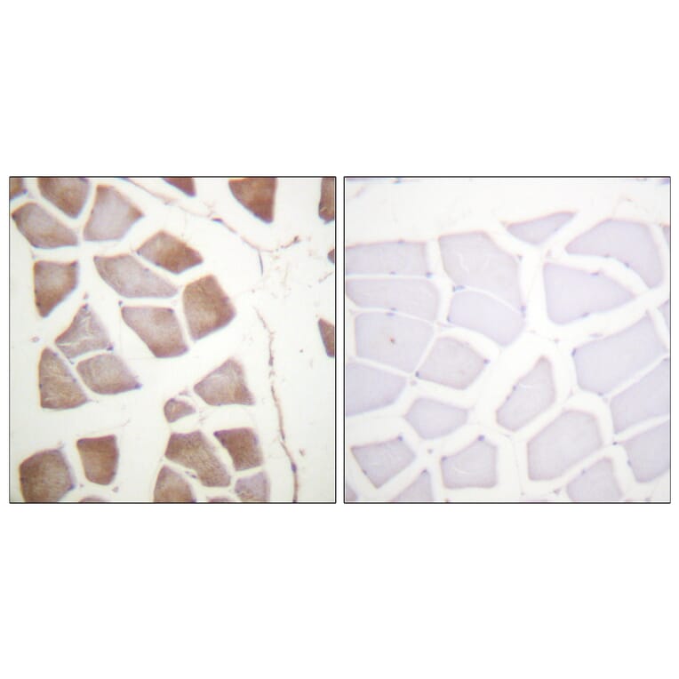 Immunohistochemistry - Anti-DAPK2 Antibody (B0899) - Antibodies.com