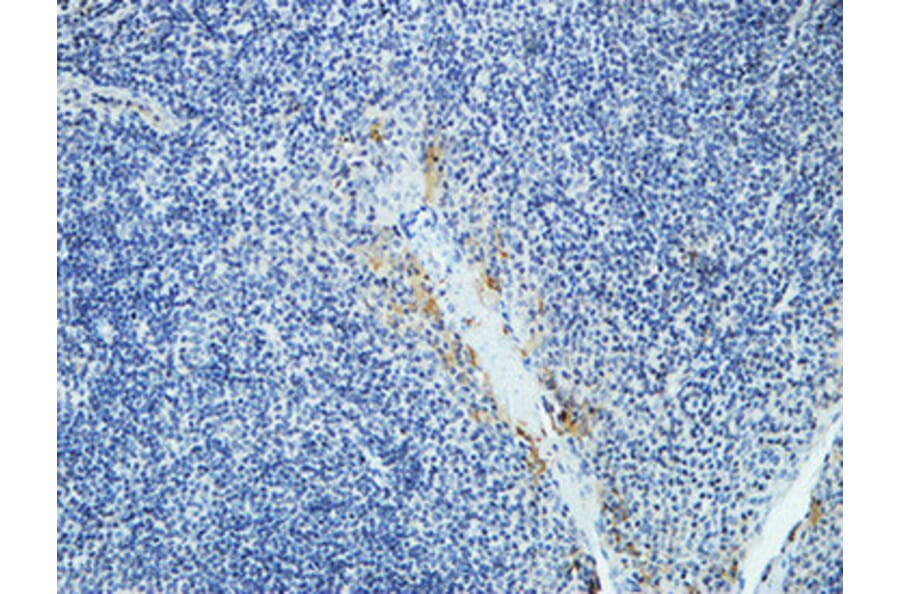 Immunohistochemistry - Anti-DAPK2 Antibody (B0899) - Antibodies.com