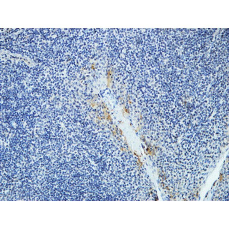 Immunohistochemistry - Anti-DAPK2 Antibody (B0899) - Antibodies.com
