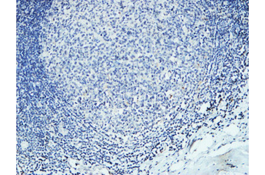 Immunohistochemistry - Anti-DAPK2 Antibody (B0899) - Antibodies.com