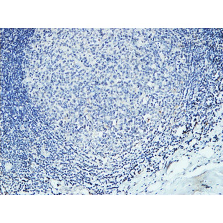 Immunohistochemistry - Anti-DAPK2 Antibody (B0899) - Antibodies.com