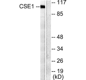 Western Blot - Anti-CSE1L Antibody (C0146) - Antibodies.com