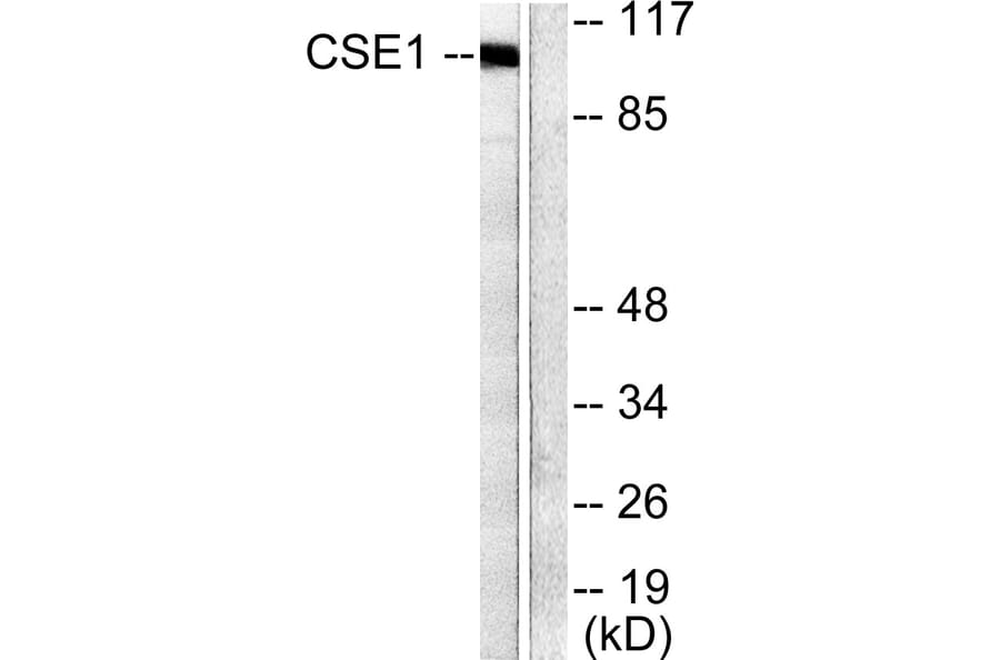 Western Blot - Anti-CSE1L Antibody (C0146) - Antibodies.com