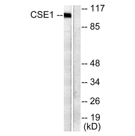 Western Blot - Anti-CSE1L Antibody (C0146) - Antibodies.com