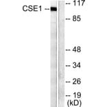 Western Blot - Anti-CSE1L Antibody (C0146) - Antibodies.com