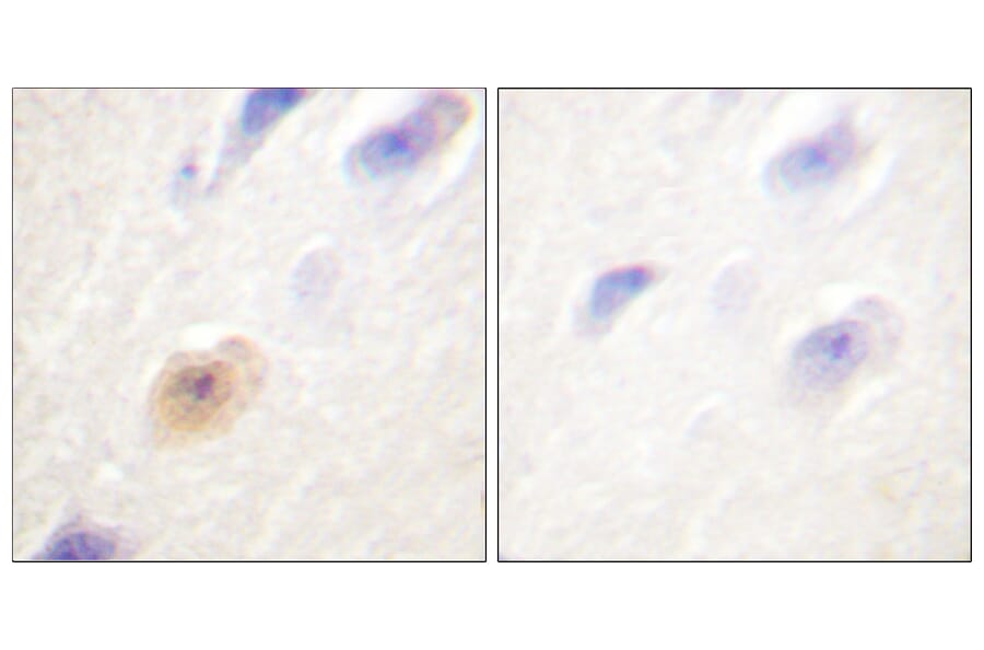 Immunohistochemistry - Anti-CSE1L Antibody (C0146) - Antibodies.com