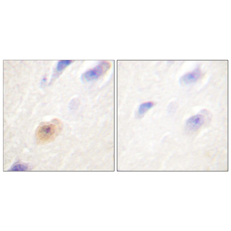 Immunohistochemistry - Anti-CSE1L Antibody (C0146) - Antibodies.com