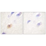 Immunohistochemistry - Anti-CSE1L Antibody (C0146) - Antibodies.com