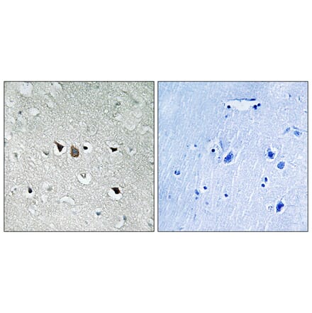 Immunohistochemistry - Anti-C-RAF Antibody (B8177) - Antibodies.com