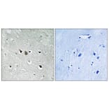 Immunohistochemistry - Anti-C-RAF Antibody (B8177) - Antibodies.com