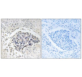 Immunohistochemistry - Anti-CPNE8 Antibody (C15250) - Antibodies.com