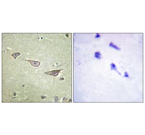 Immunohistochemistry - Anti-COX15 Antibody (C12230) - Antibodies.com